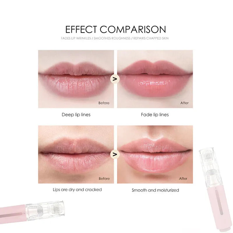 Lip Care Roller with Serum